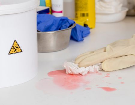 Why You Should Leave Biohazard Cleaning to the Professionals