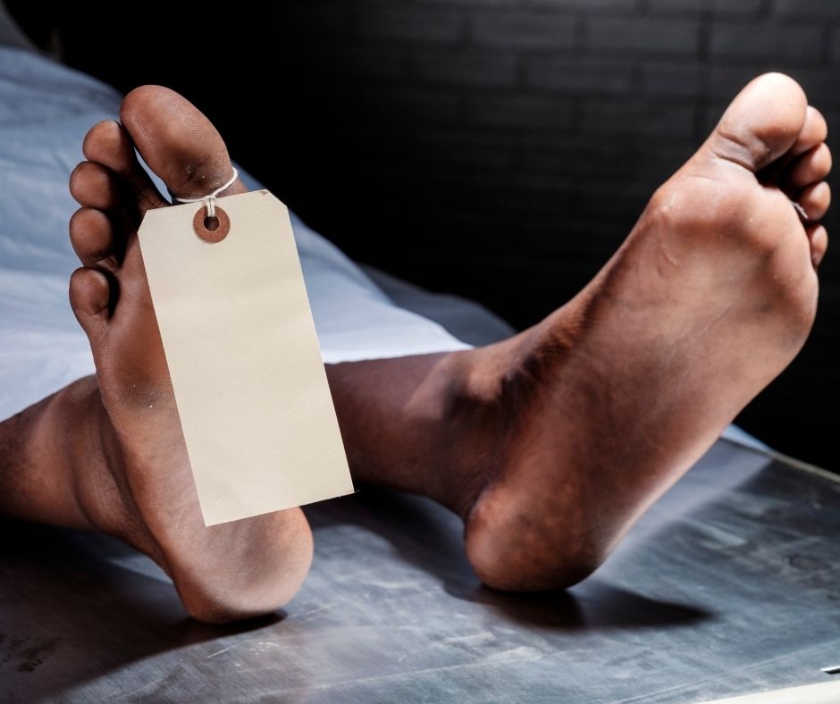 What Happens to a Dead Body After 3 Days? | Affinity Bio Solutions AZ