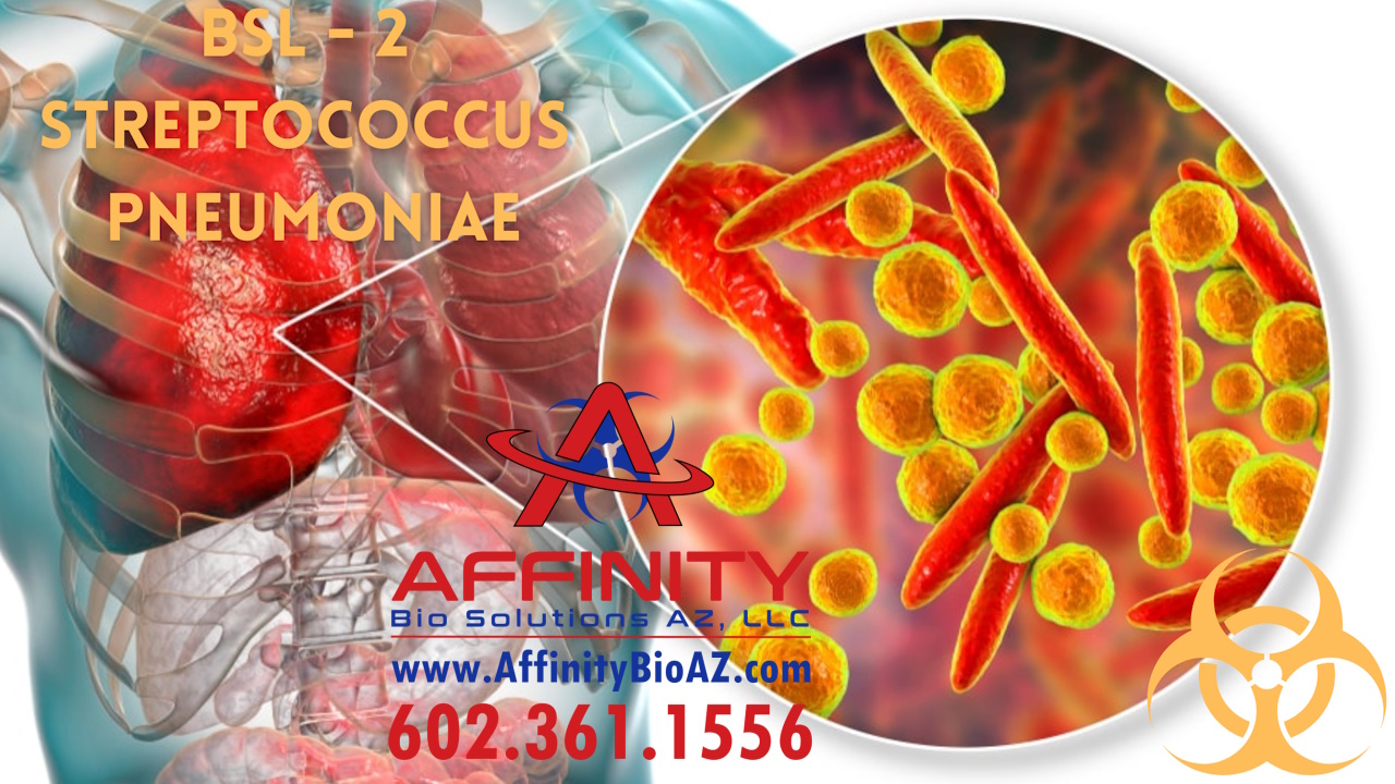 Phoenix Biohazard Cleanup - Streptococcus Pneumoniae Bacteria Biohazards at Crime Scene Cleanup in Arizona