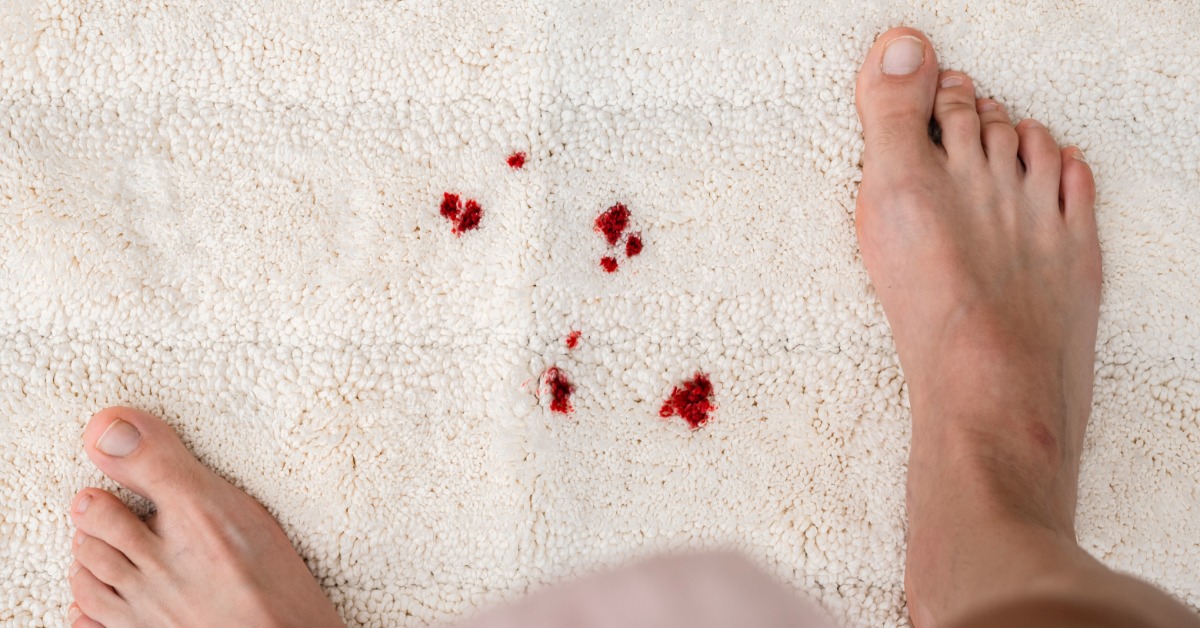 a top view of red drops on a white fluffy carpet, with bare feet partly visible near the stained area.