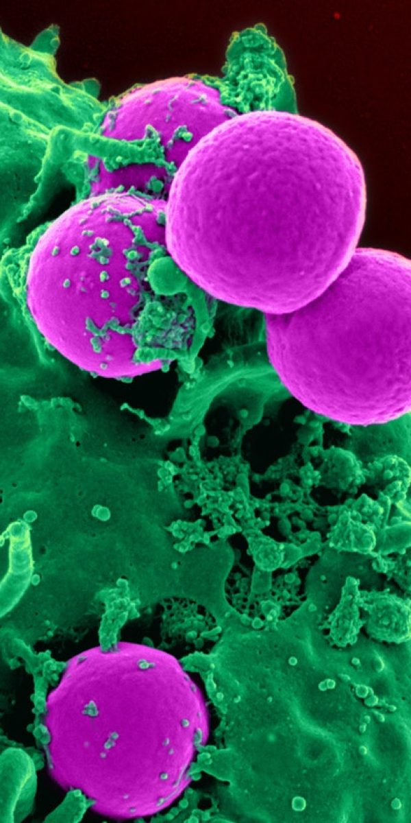 Phoenix Arizona viricidal and bacterial disinfection and sanitation Scottsdale Glendale Goodyear SUn City Peoria Mesa Tempe Chandler Gilbert